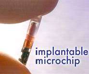 Implantable microchip